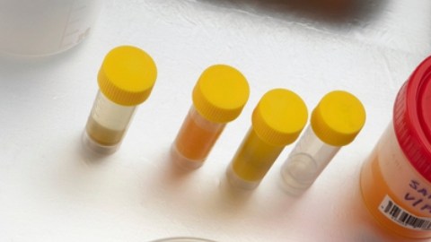 La gripe aviar puede mutar, según un nuevo estudio