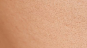 Vacuna contra el herpes zóster podría retrasar la demencia