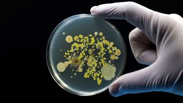 Reportan dos muertos por brote de listeria en Estados Unidos