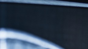 Cómo se comporta el cerebro luego de la muerte: esto dice un estudio