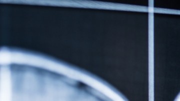 Cómo se comporta el cerebro luego de la muerte: esto dice un estudio