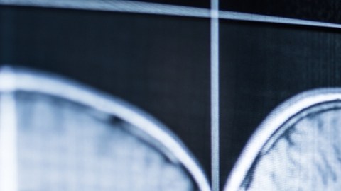 Cómo se comporta el cerebro luego de la muerte: esto dice un estudio