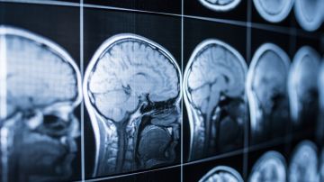 Cómo se comporta el cerebro luego de la muerte: esto dice un estudio