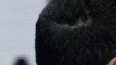 La nadadora eslovaca Tamara Potocka siendo retirada en camilla en una imagen que generó mucha preocupación en los Juegos Olímpicos París 2024.