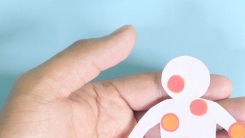 CDC dicen que los casos de parvovirus están aumentando: de qué se trata