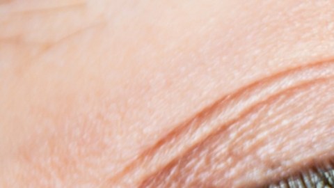 Cambio de color de ojos y otras cirugías estéticas que te pueden poner en riesgo