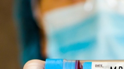 La OMS lanza plan para global para contener la mpox