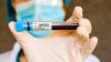 La OMS lanza plan para global para contener la mpox