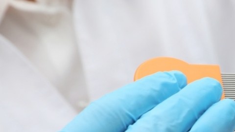 Los CDC cambian sus normas sobre los piojos y las escuelas