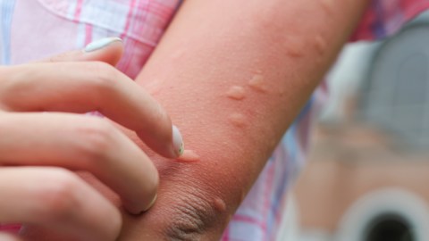 Los mosquitos pueden encontrarnos a través del calor corporal