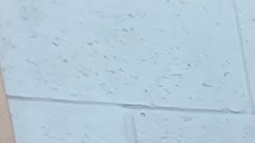 Una persona sin hogar recibe atención médica como parte del programa de medicina callejera de UCLA.