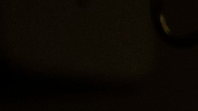 Dr. Sunil Singhal, center, directs a special camera to look at a patient's tumor, made visible with fluorescent dye, on monitors at the Hospital of the University of Pennsylvania in Philadelphia, Tuesday, Jan. 23, 2018. Researchers are testing fluorescent dyes that make cancer cells glow to make them easier for surgeons to find, giving patients a better shot at survival. (AP Photo/Matt Rourke)