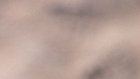 Microplasticos se están infiltrando en el tejido cerebral humano