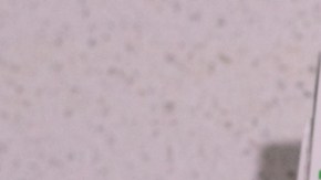 Zepbound de Eli Lilly reduce "drásticamente" el riesgo de diabetes