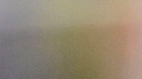 El portero alemán del FC Barcelona, Marc-Andre Ter Stegen, podría perderse toda la temporada por lesión.