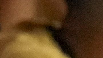 Messi se lesionó en la Copa América.