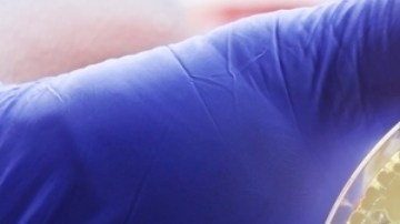 La resistencia a los antimicrobianos podría causar 39 millones de muertes entre 2025 y 2050, según un estudio. Urge mejorar el acceso a medicamentos y atención médica.