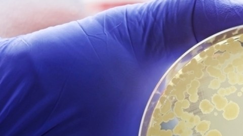 La resistencia a los antimicrobianos podría causar 39 millones de muertes entre 2025 y 2050, según un estudio. Urge mejorar el acceso a medicamentos y atención médica.