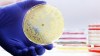 La resistencia a los antimicrobianos podría causar 39 millones de muertes entre 2025 y 2050, según un estudio. Urge mejorar el acceso a medicamentos y atención médica.