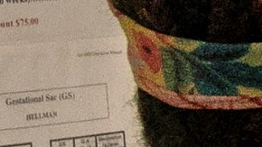 Juez de Dakota del Norte anula prohibición casi total del aborto en el estado