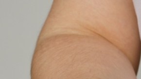 Investigación asocia la semaglutida con menor riesgo de sobredosis de opioides