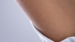 Descubren vínculo entre la sudoración excesiva y la piel sensible