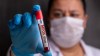El Congo inicia la vacunación contra mpox en provincias prioritarias