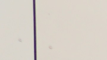 Los simpatizantes de la Medida A se muestran optimistas.