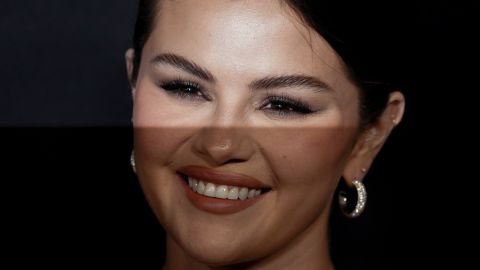 Selena Gomez se muestra al natural: selfie sin maquillaje y con acné