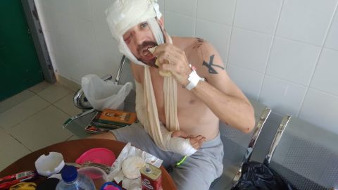 "Un rebaño de cabras me salvó la vida tras pasar 3 días malherido y solo en la jungla"