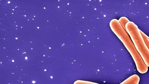 La bacteria Mycobacterium tuberculosis causa la tuberculosis y es uno de los patógenos más peligrosos del mundo.