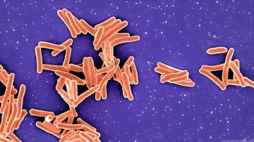 La bacteria Mycobacterium tuberculosis causa la tuberculosis y es uno de los patógenos más peligrosos del mundo.
