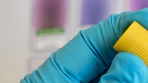 Melioidosis: una enfermedad de jardín ha cobrado la vida de 5 personas en australia