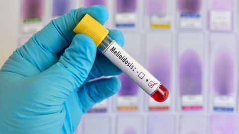 Melioidosis: una enfermedad de jardín ha cobrado la vida de 5 personas en australia