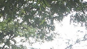 Lula se recupera tras cirugía por hemorragia intracraneal