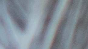 La sordera influye en el deterioro cognitivo