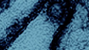 Esta imagen de microscopio electrónico coloreada publicada por el Instituto Nacional de Alergias y Enfermedades Infecciosas, el 26 de marzo de 2024, muestra partículas del virus de la gripe aviar A H5N1 (amarillo), cultivadas en células epiteliales de riñón canino Madin-Darby (MDCK) (azul). (CDC/NIAID vía AP)