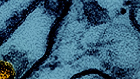 Esta imagen de microscopio electrónico coloreada publicada por el Instituto Nacional de Alergias y Enfermedades Infecciosas, el 26 de marzo de 2024, muestra partículas del virus de la gripe aviar A H5N1 (amarillo), cultivadas en células epiteliales de riñón canino Madin-Darby (MDCK) (azul). (CDC/NIAID vía AP)