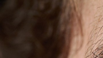 Virus del sangrado ocular: por qué está despertando alerta mundial