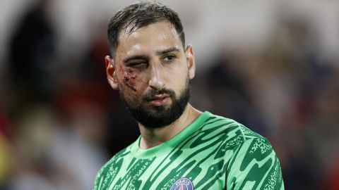 Donnarumma se ausentará del club durante varios días.