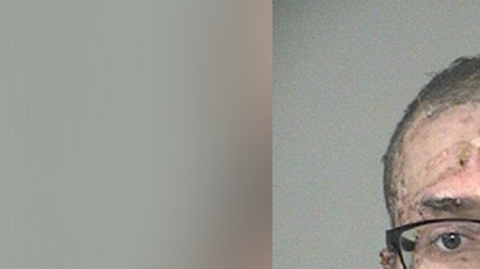 Pedro Luis Parra Pulgar, de 46 años, está acusado de tres cargos de intento de asesinato.