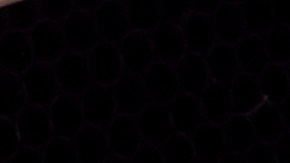 Consumo de carne roja procesada puede llevar a la demencia temprana