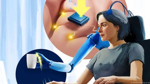 Los investigadores crearon mapas detallados del cerebro que permitieron ubicar con precisión las zonas correspondientes a cada parte de la mano protésica.
