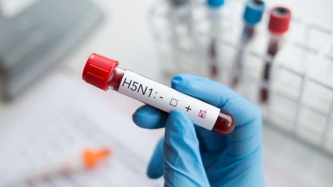 La primera muerte por gripe aviar en Estados Unidos se registra en Louisiana