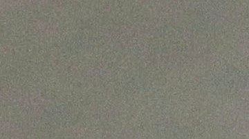 El papa Francisco experimenta una "leve mejoría" y la insuficiencia renal "no es preocupante"