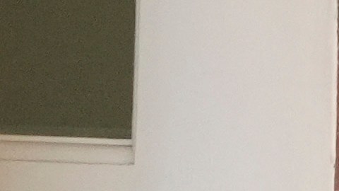 Surgen preguntas después de que Trump es fotografiado con grandes moretones en sus manos.