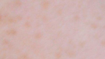 In this Friday, July 21, 2017 photo, a woman is handcuffed after being searched by police for suspected drug paraphernalia at a city park in Delray Beach, Fla. As drug addiction destroys families across America, “there’s a need for a positive, vibrant recovery network to help people get off of opioids,” said State Attorney Dave Aronberg, chief prosecutor in Palm Beach County. “You can’t just arrest your way out of this problem.” But lately, South Florida has become the focal point of rampant insurance fraud that relies on a lethal cycle of failure, authorities say. (AP Photo/Lynne Sladky)