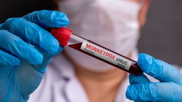 Nueva York confirma el primer caso de la nueva cepa mpox