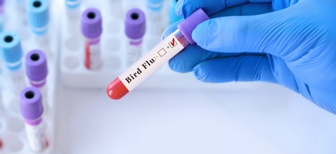 Un adulto de Nevada se infecta con una nueva cepa de gripe aviar