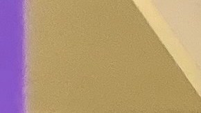 Alerta: retiran detergente Woolite vendido en Amazon por riesgo de bacterias